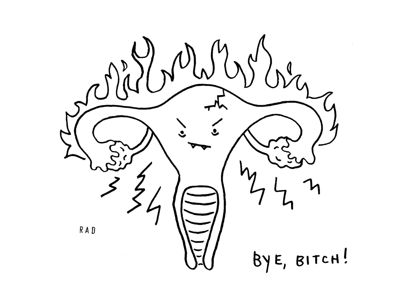 Bye, B!tch! Hysterectomy Print 8"x10"